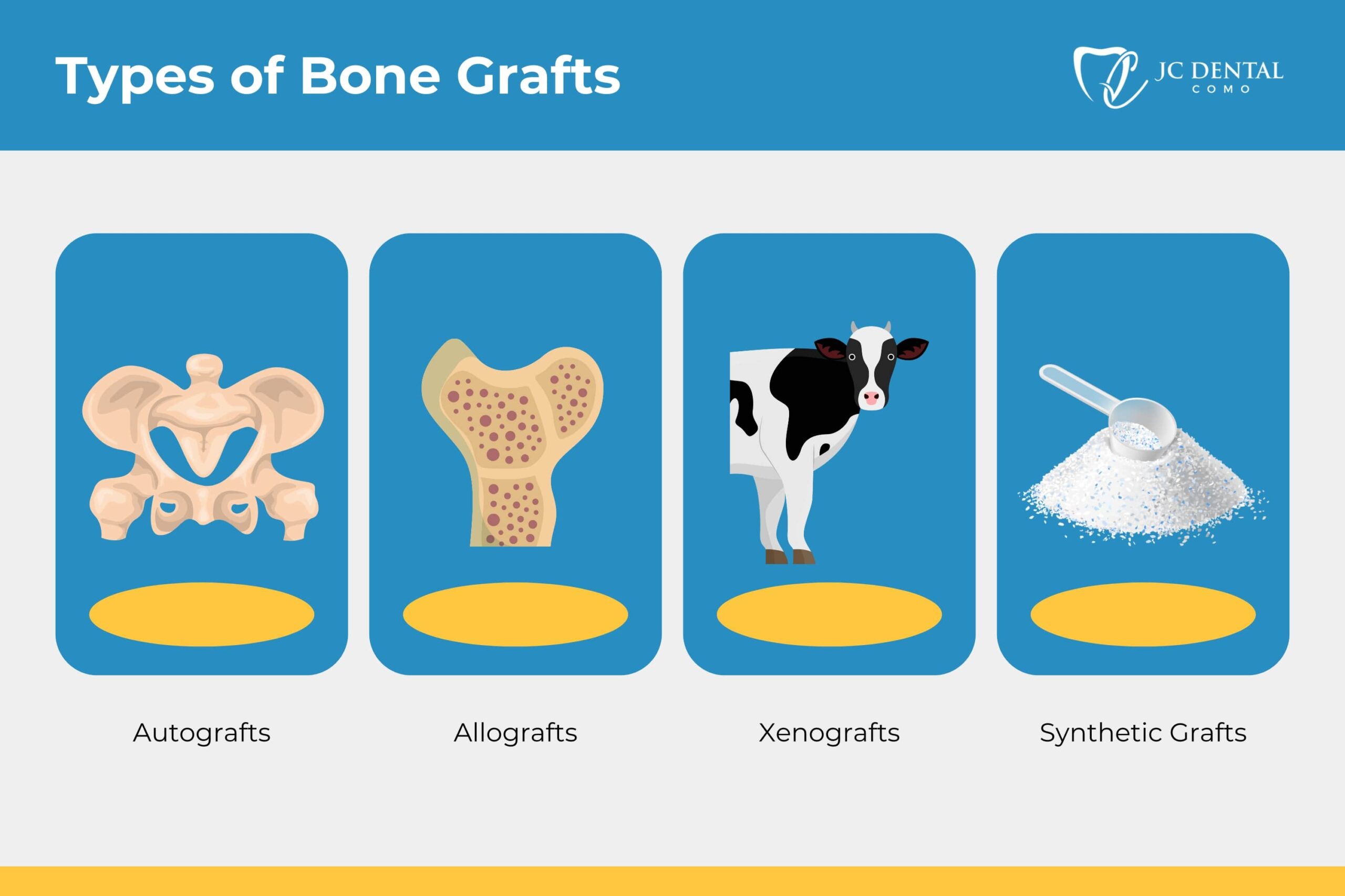 Types of Bone Grafts