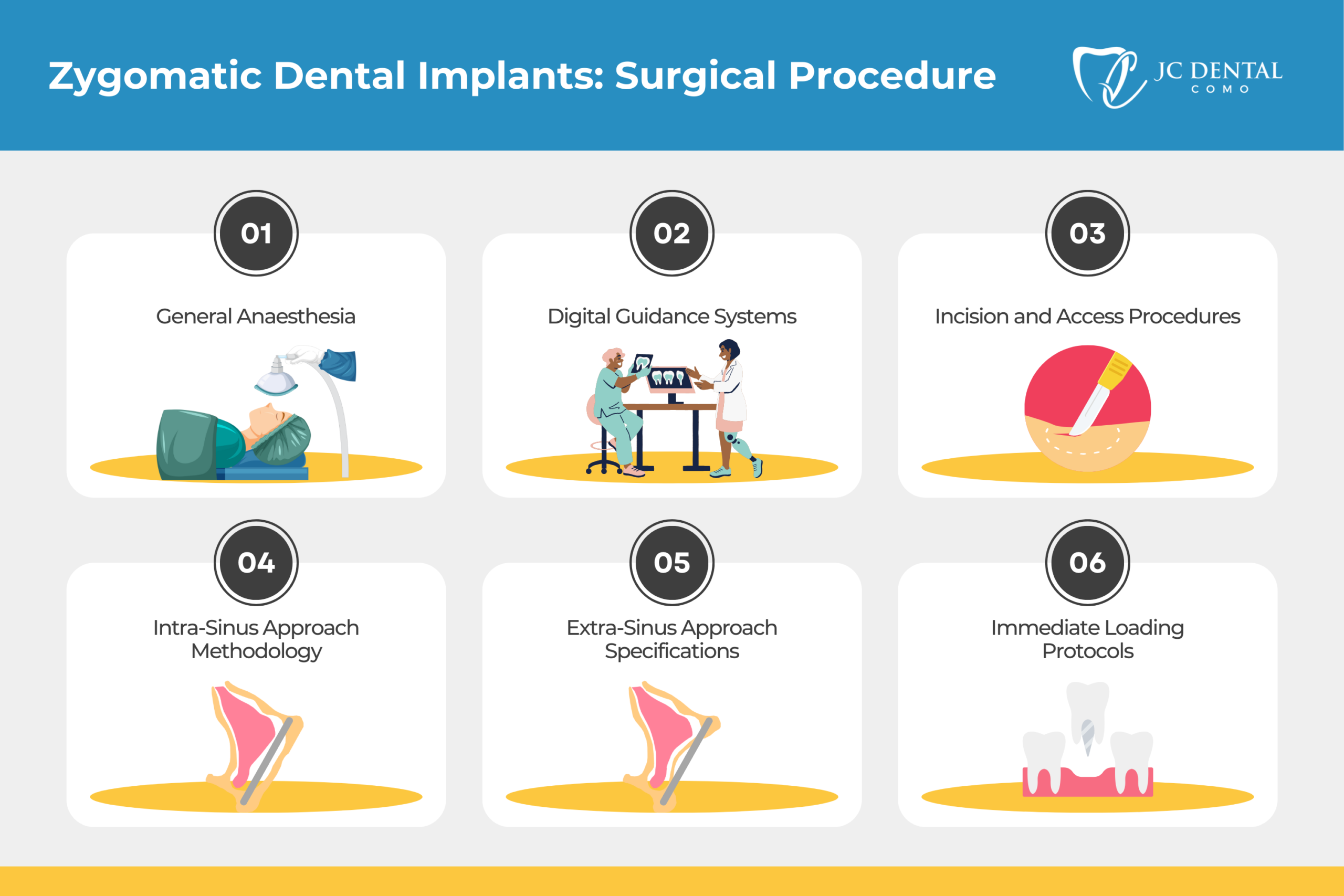 Zygomatic Dental Implants Surgical Procedure