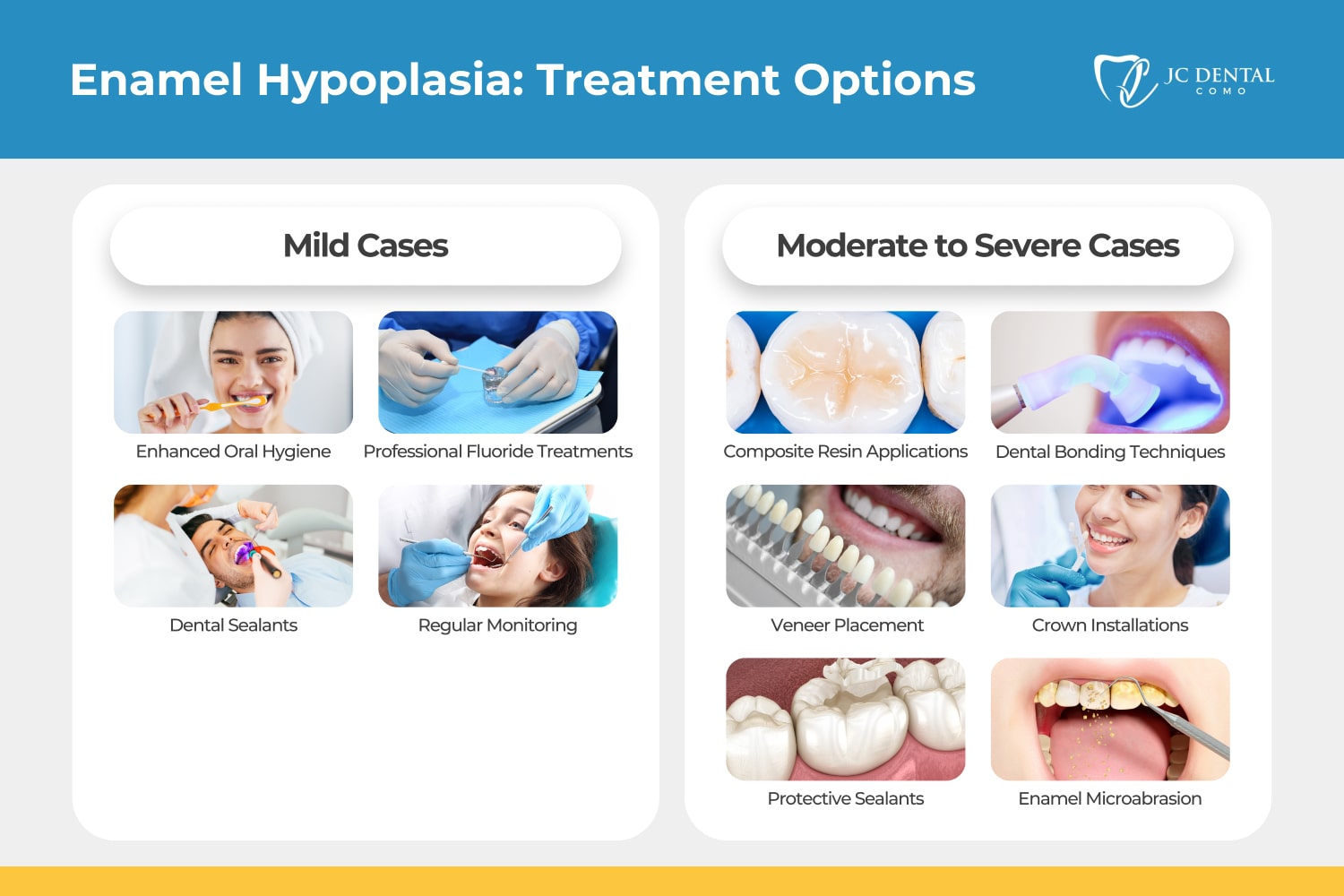 Enamel Hypoplasia - Treatment Options