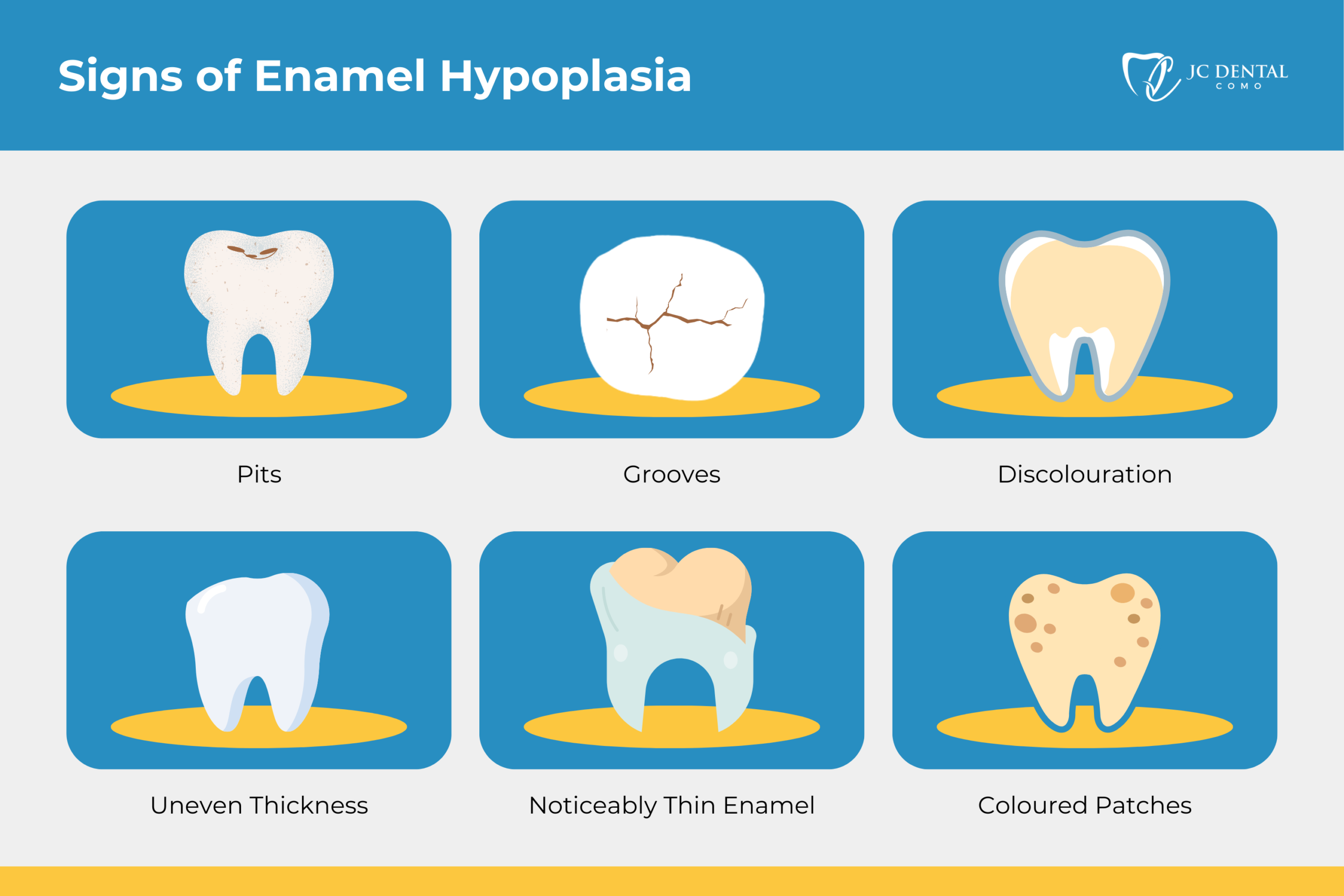 Signs of Enamel Hypoplasia