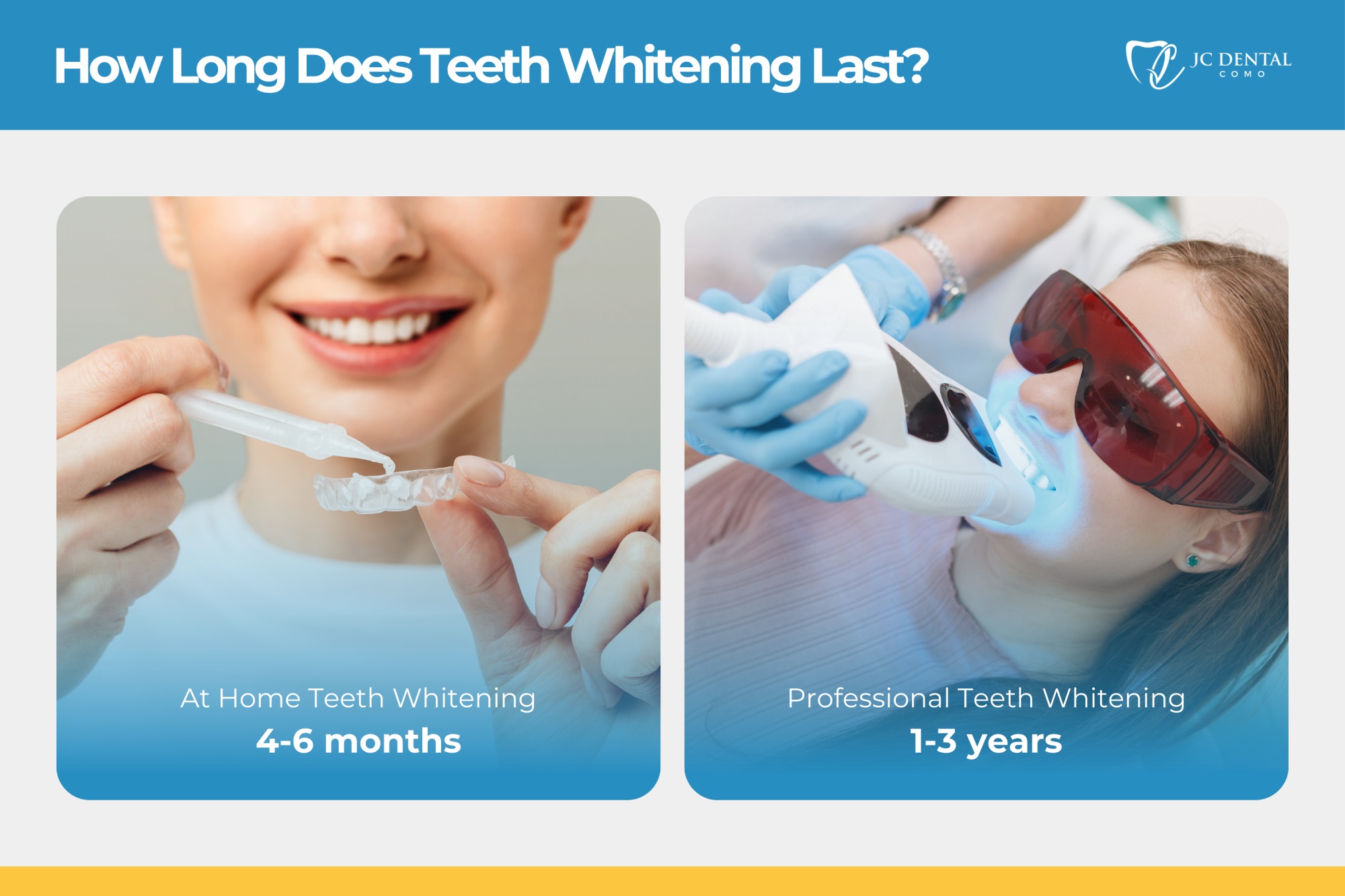 How long does Teeth Whitening Last
